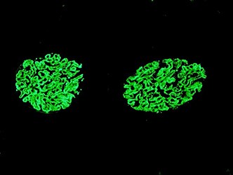 Immunofluorescent Staining for IgG, two samples.